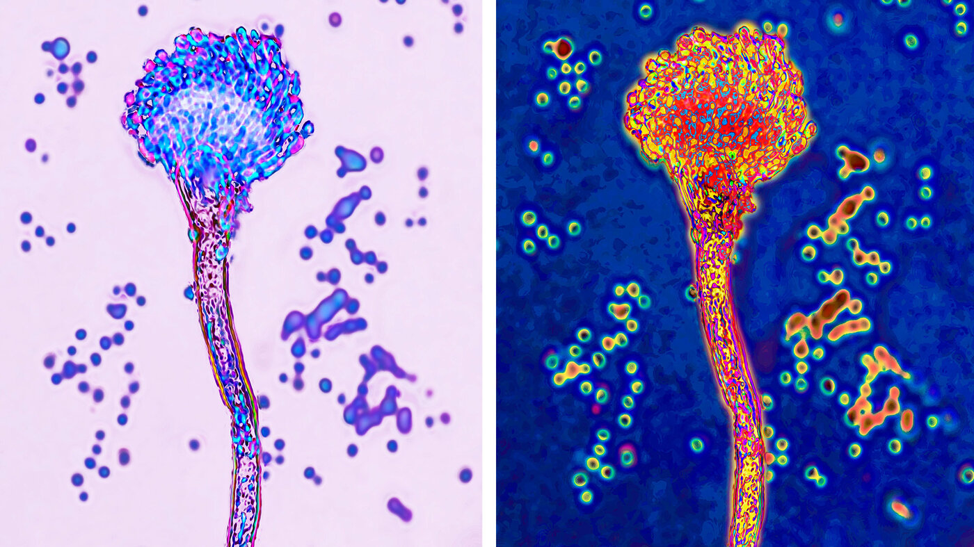 Deadly Fungi: Why These Forgotten Pathogens Are a Growing Concern